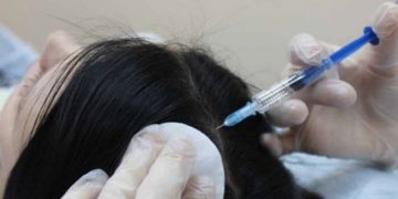 Ozonoterapie injectabilă pentru păr